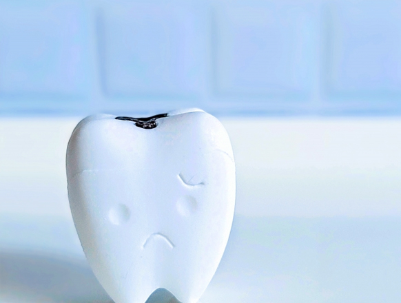 コンポジットレジンの使用