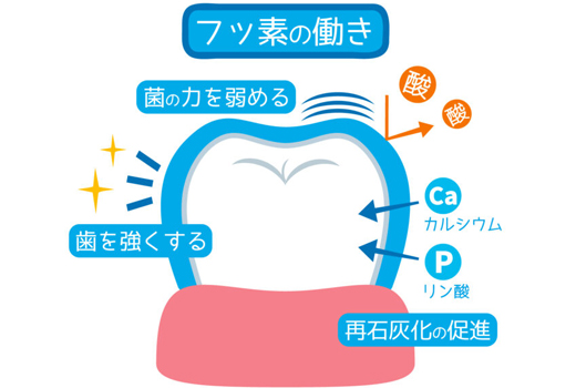 3. フッ素塗布