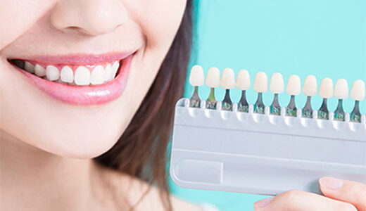 ホワイトニング